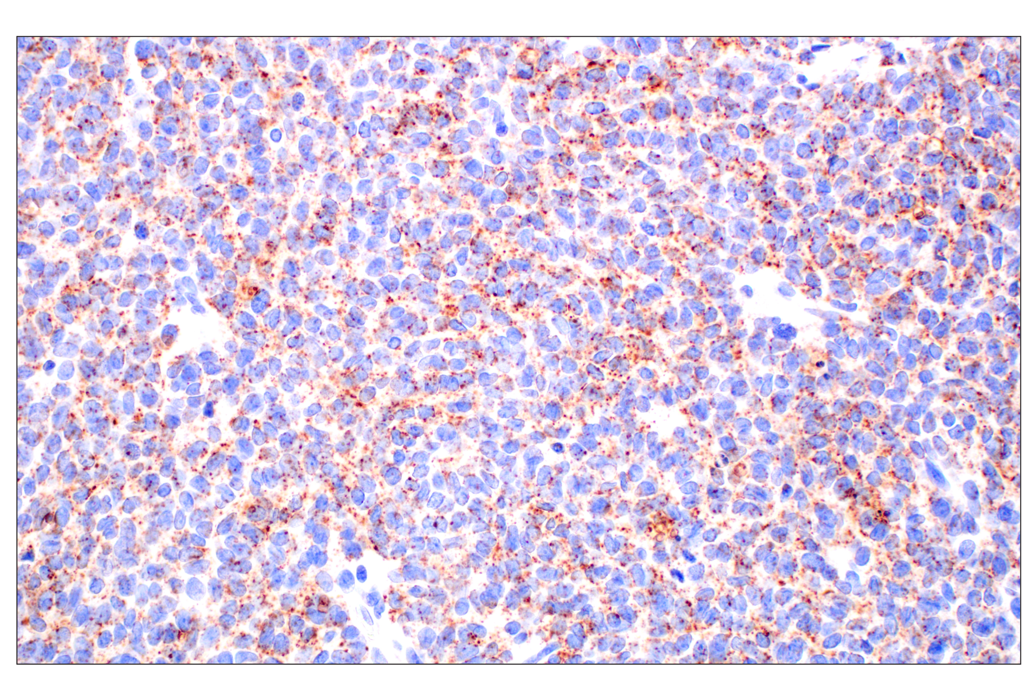 Immunohistochemistry Image 2: NPC1 (E7S4N) Rabbit mAb