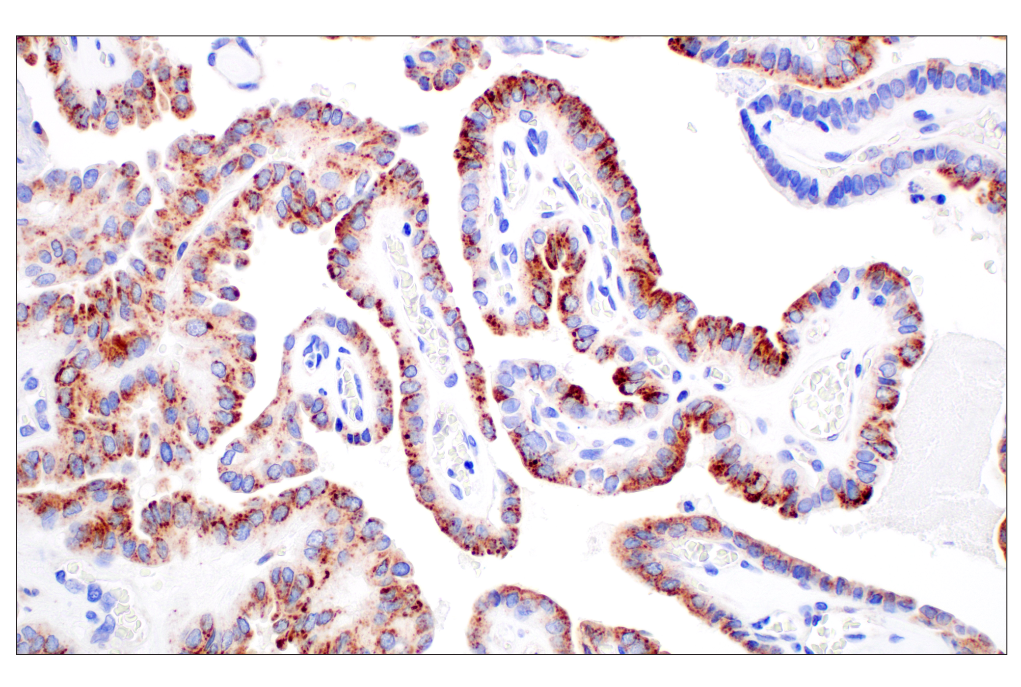 Immunohistochemistry Image 4: NPC1 (E7S4N) Rabbit mAb