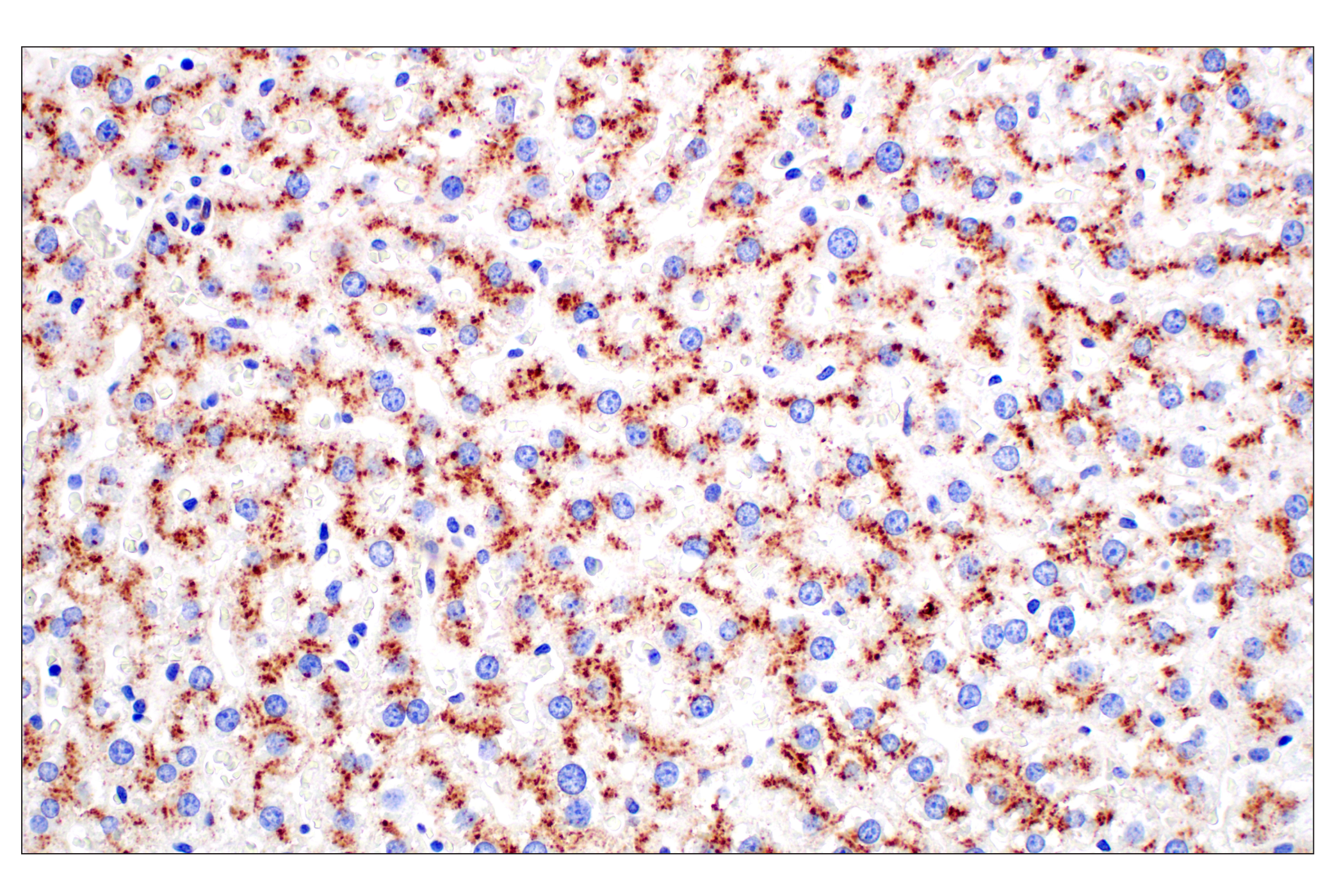 Immunohistochemistry Image 10: NPC1 (E7S4N) Rabbit mAb