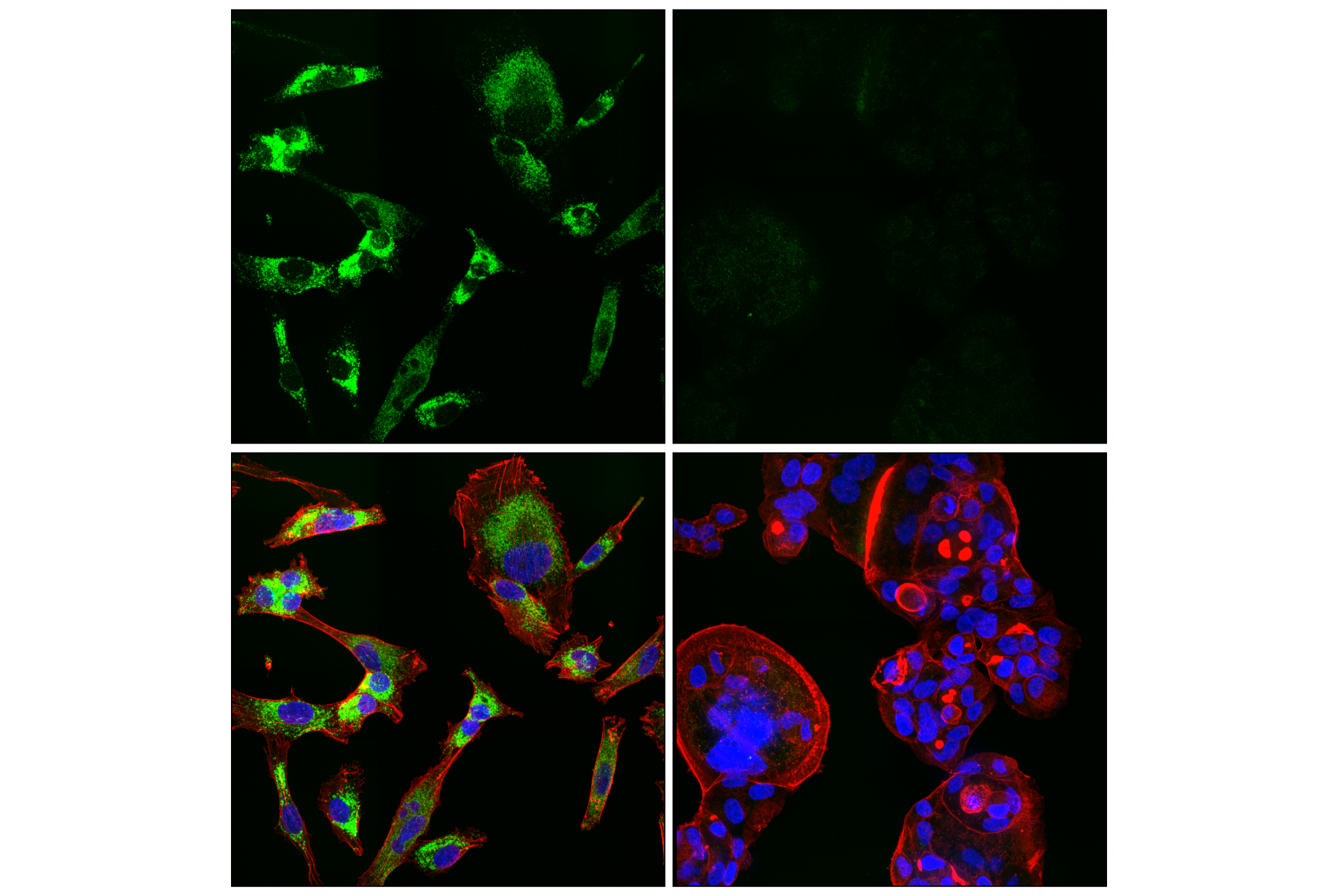 Immunofluorescence Image 1: NPC1 (E7S4N) Rabbit mAb