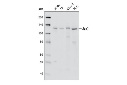  Image 3: Phospho-Jak Family Antibody Sampler Kit
