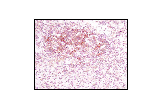 Immunohistochemistry Image 2: NME1/NDKA (D98) Antibody