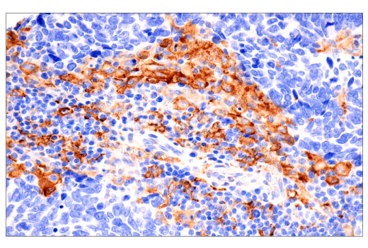 Immunohistochemistry Image 1: FcRn (E9J8W) Rabbit mAb (BSA and Azide Free)