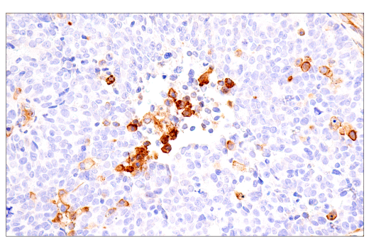 Immunohistochemistry Image 6: FcRn (E9J8W) Rabbit mAb (BSA and Azide Free)