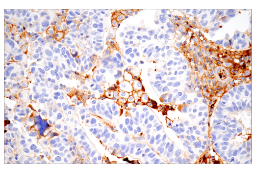 Immunohistochemistry Image 6: IgG (RWP49) Mouse mAb