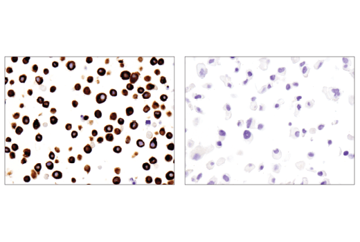Immunohistochemistry Image 2: Nestin (10C2) Mouse mAb