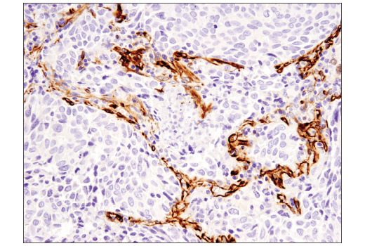 Immunohistochemistry Image 3: Nestin (10C2) Mouse mAb