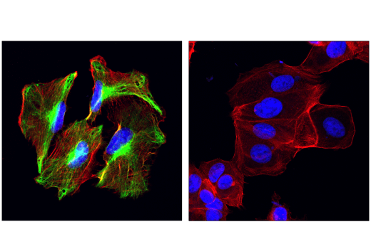 Immunofluorescence Image 1: Nestin (10C2) Mouse mAb