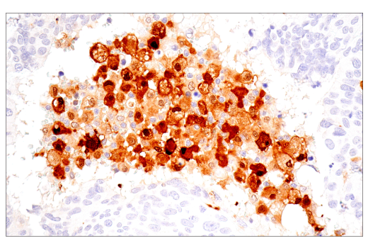 Immunohistochemistry Image 3: IL-18 (E3G8R) Rabbit mAb (BSA and Azide Free)