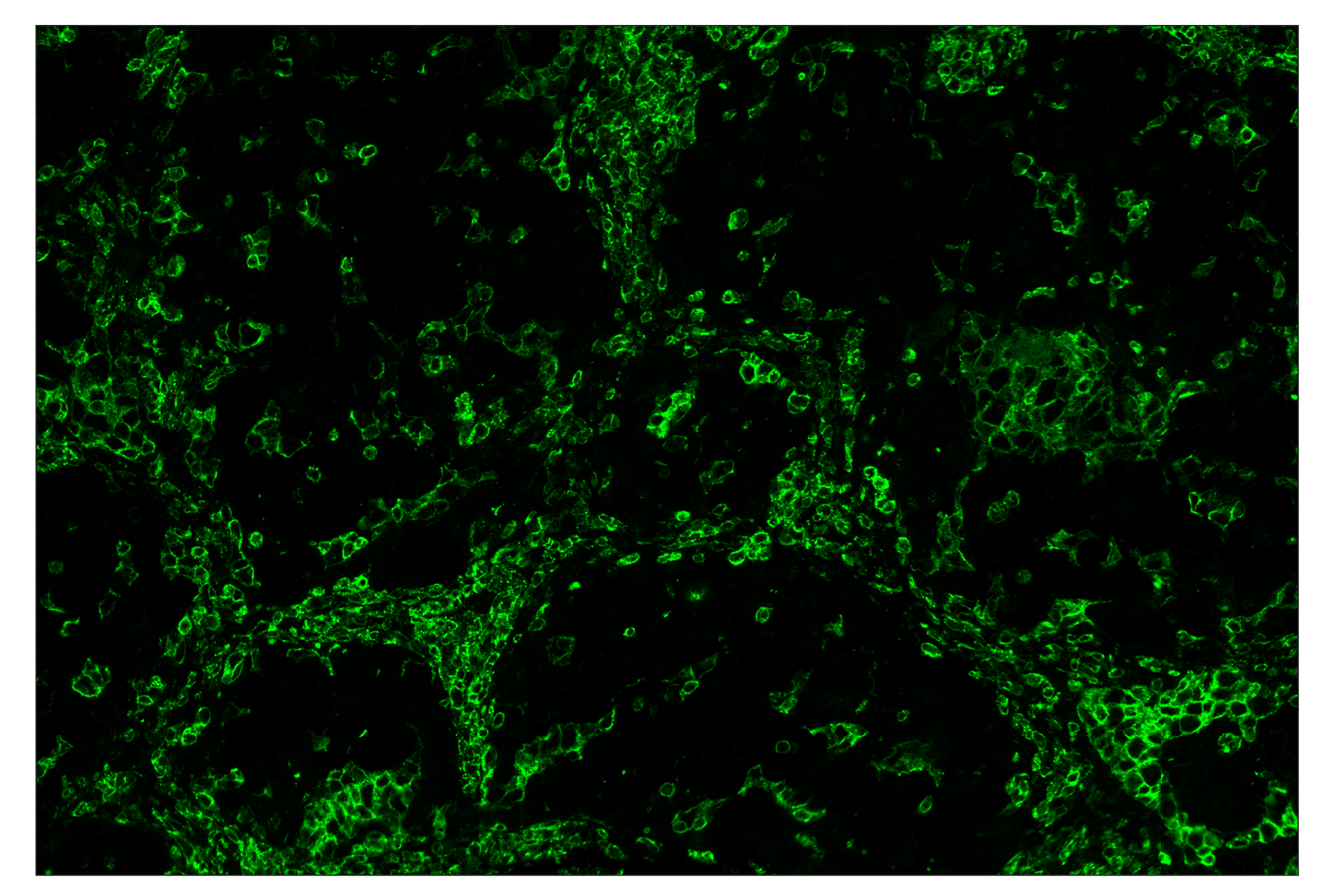 Immunohistochemistry Image 2: CD45 (Intracellular Domain) (D9M8I) & CO-0013-647 SignalStar™ Oligo-Antibody Pair