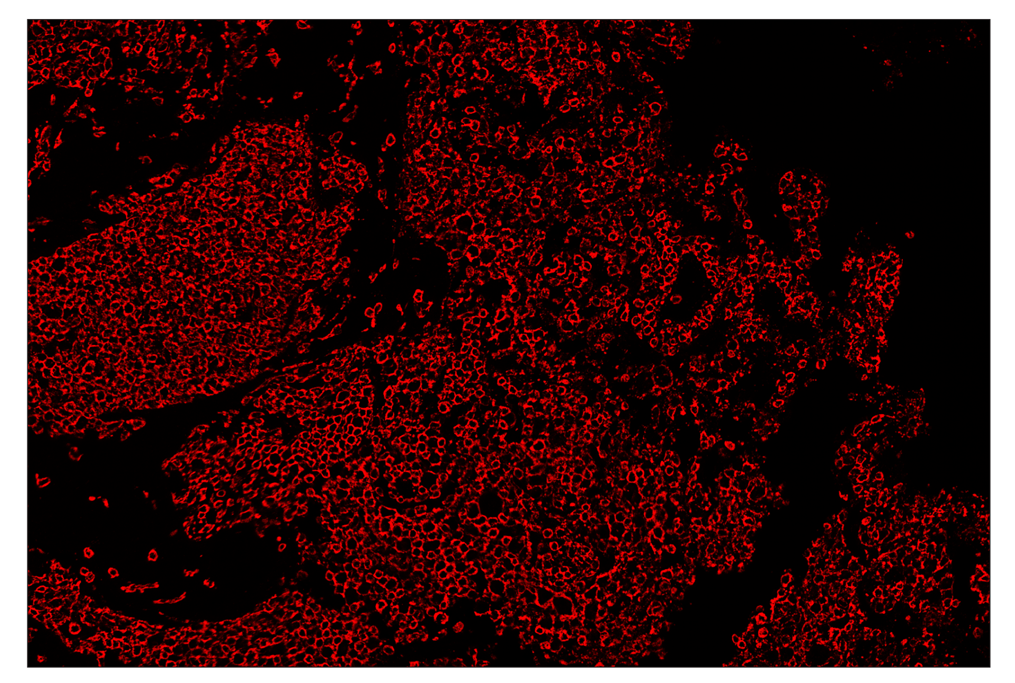 Immunohistochemistry Image 4: CD45 (Intracellular Domain) (D9M8I) & CO-0013-647 SignalStar™ Oligo-Antibody Pair