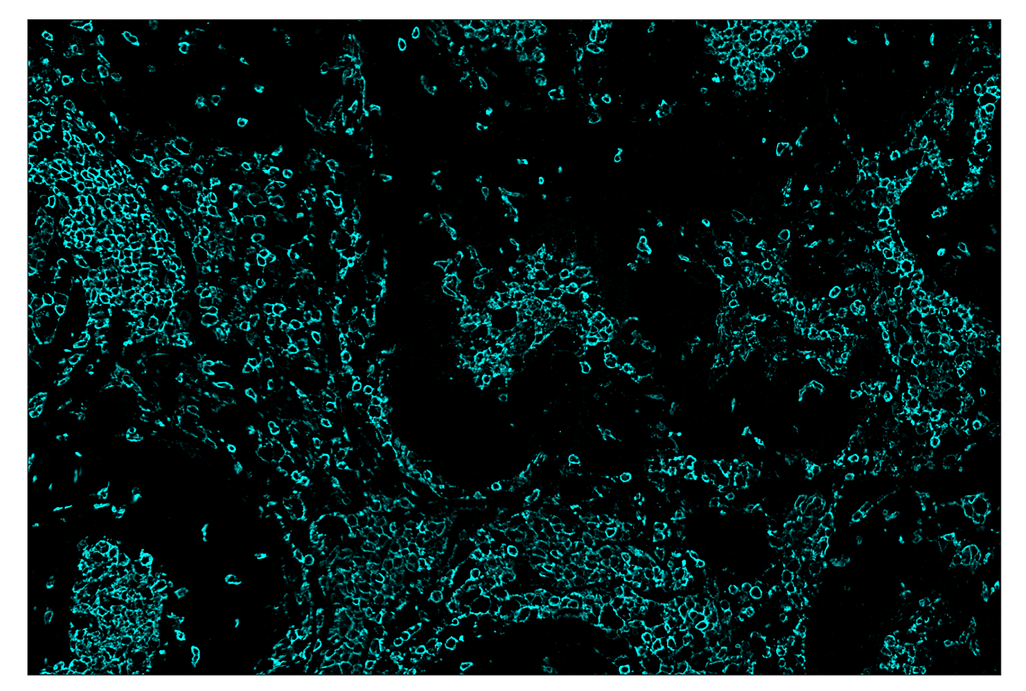 Immunohistochemistry Image 5: CD45 (Intracellular Domain) (D9M8I) & CO-0013-750 SignalStar™ Oligo-Antibody Pair