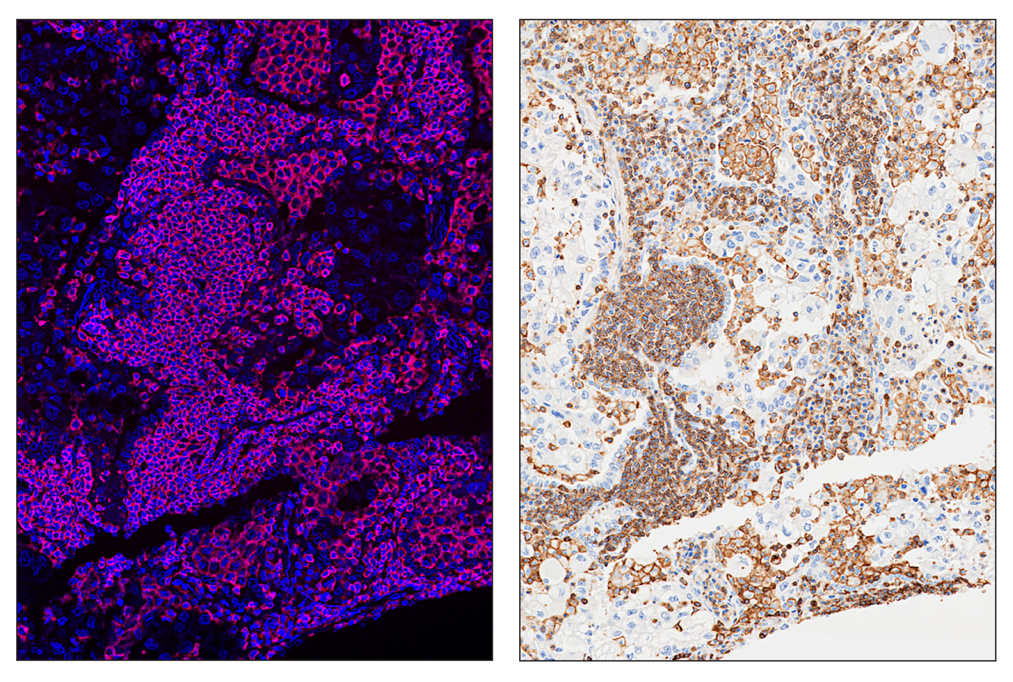 Immunohistochemistry Image 6: CD45 (Intracellular Domain) (D9M8I) & CO-0013-750 SignalStar™ Oligo-Antibody Pair