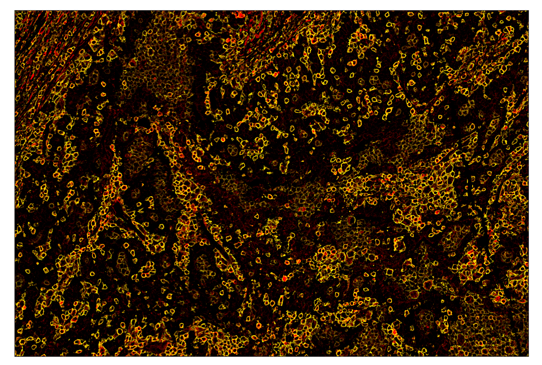 Immunohistochemistry Image 8: CD45 (Intracellular Domain) (D9M8I) & CO-0013-647 SignalStar™ Oligo-Antibody Pair