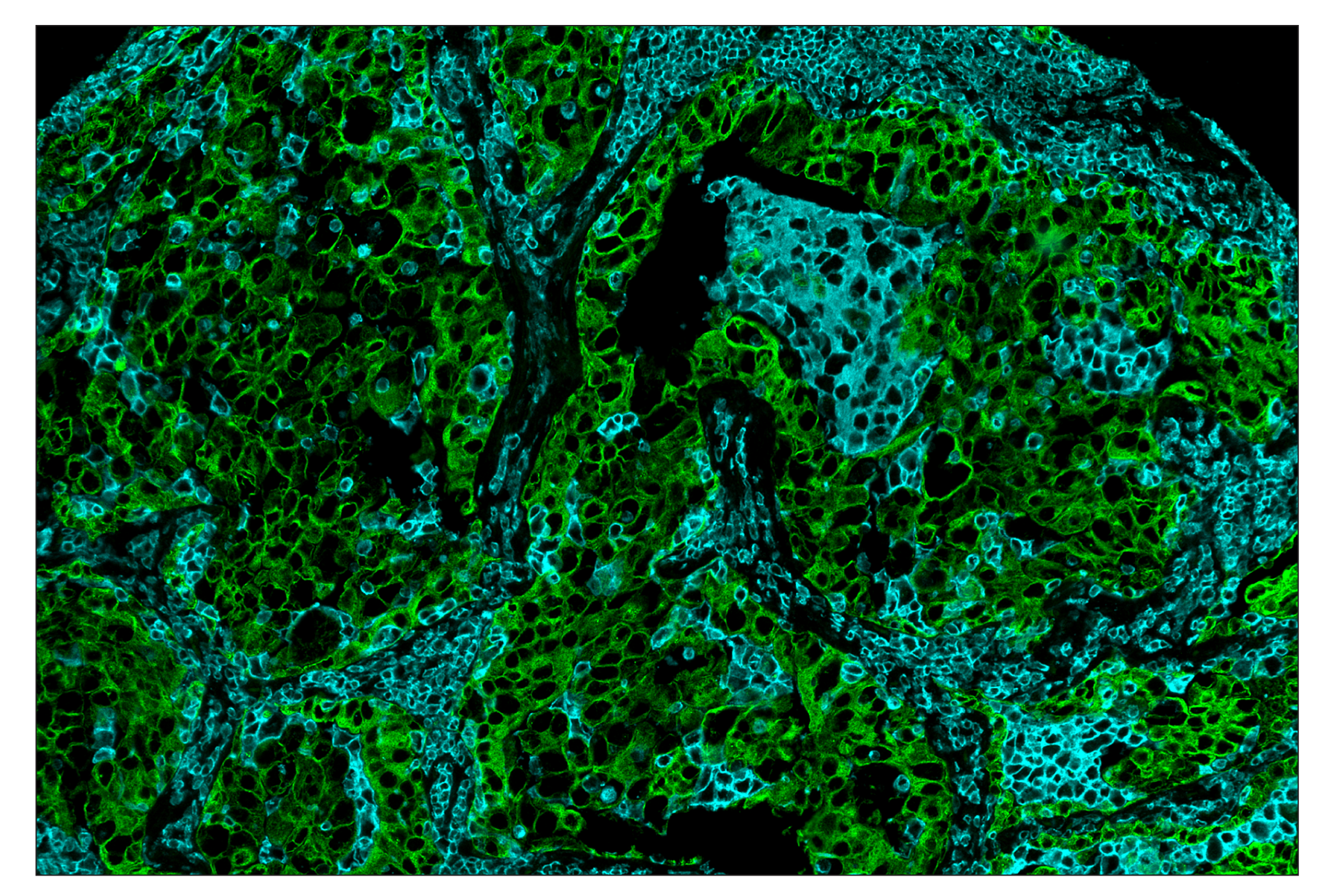 Immunohistochemistry Image 7: CD45 (Intracellular Domain) (D9M8I) & CO-0013-647 SignalStar™ Oligo-Antibody Pair