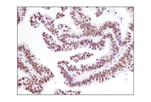 Immunohistochemistry Image 3: UTX (D3Q1I) Rabbit mAb