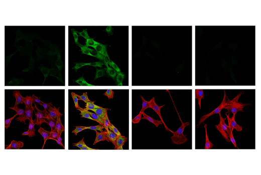 Immunofluorescence Image 1: Phospho-RIP (Ser321) (E9K2A) Rabbit mAb (BSA and Azide Free)
