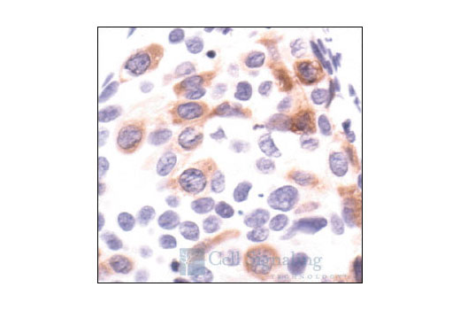 Immunohistochemistry Image 1: Stathmin Antibody