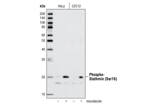 Western Blotting Image 1: Phospho-Stathmin (Ser16) Antibody