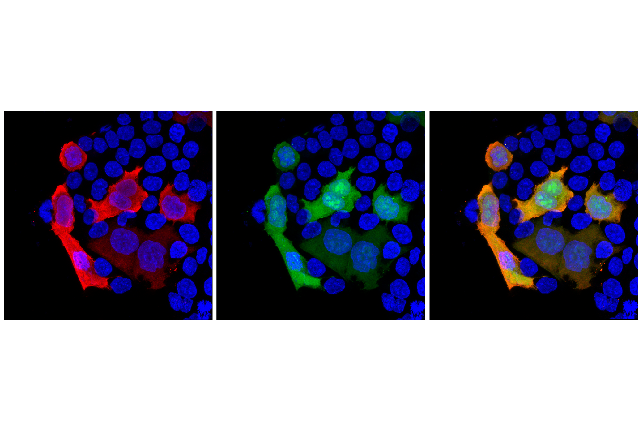 Immunofluorescence Image 1: 3X DYKDDDDK Tag (E2T2J) Mouse mAb (Binds to same epitope as Sigma-Aldrich Anti-FLAG M2 antibody)