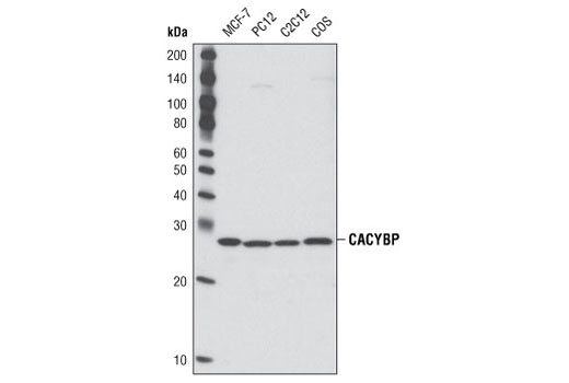 Western Blotting Image 1: CACYBP Antibody