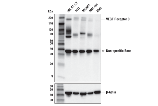 Western Blotting Image 1: VEGF Receptor 3 (D1J9Z) Rabbit mAb