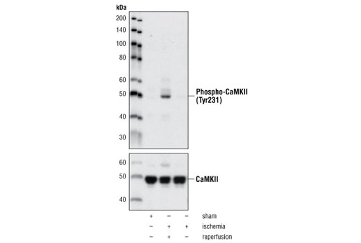 Western Blotting Image 1: Phospho-CaMKII (Tyr231) Antibody