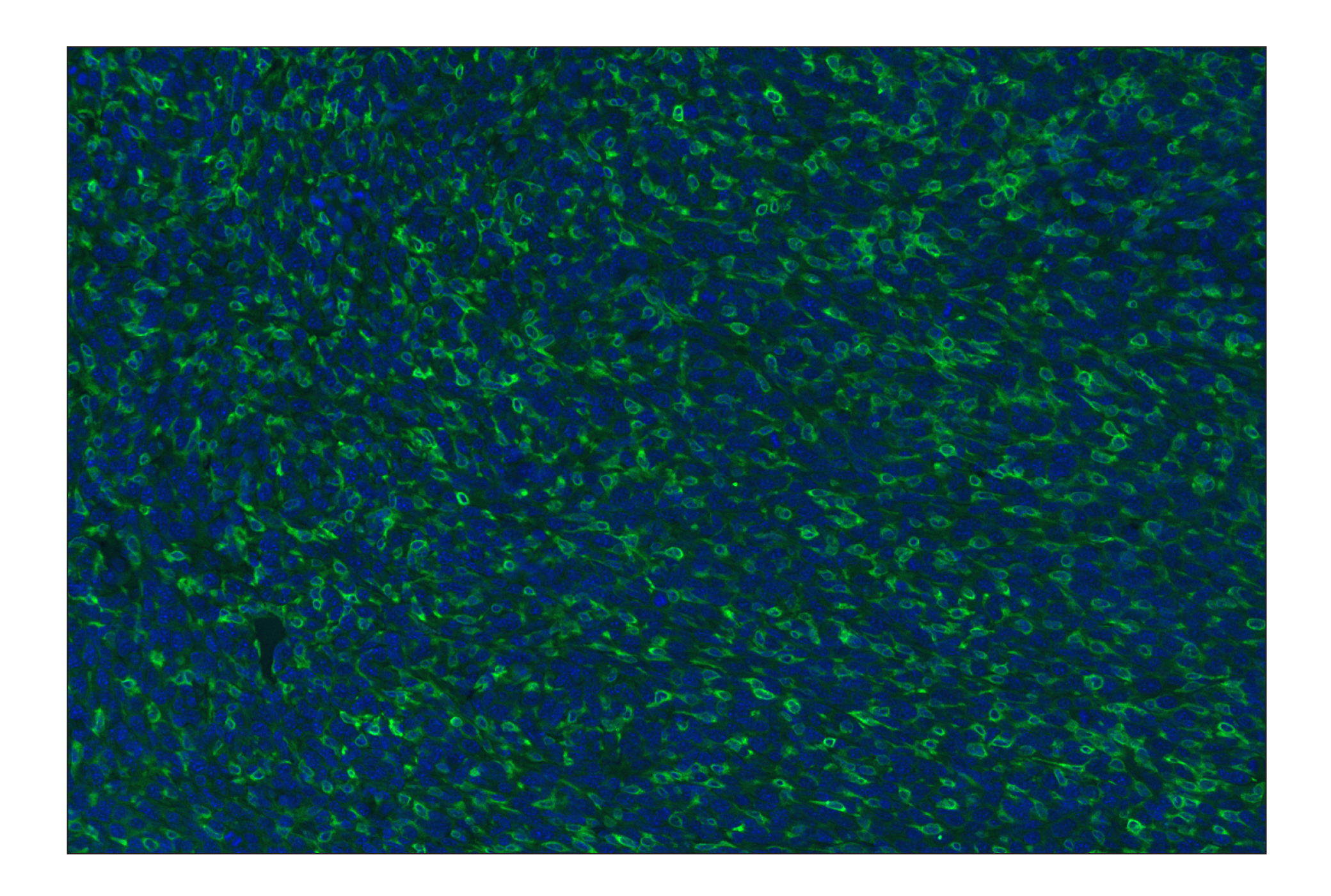 Immunohistochemistry Image 1: CD11b/ITGAM (E4K8C) Rabbit mAb (Alexa Fluor® 488 Conjugate)
