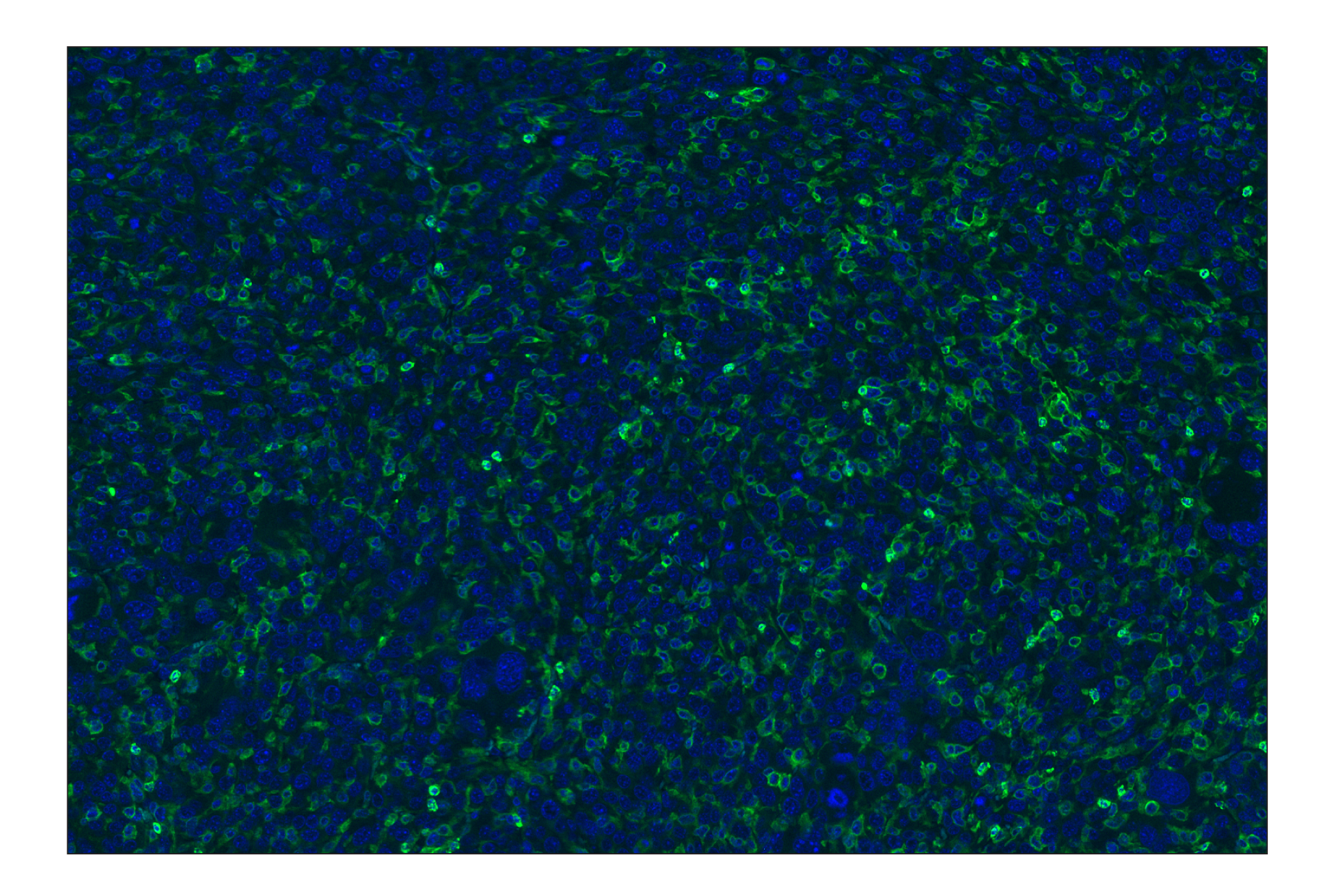 Immunohistochemistry Image 2: CD11b/ITGAM (E4K8C) Rabbit mAb (Alexa Fluor® 488 Conjugate)