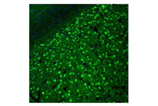 Immunofluorescence Image 2: UCHL1 (D3T2E) XP® Rabbit mAb (BSA and Azide Free)