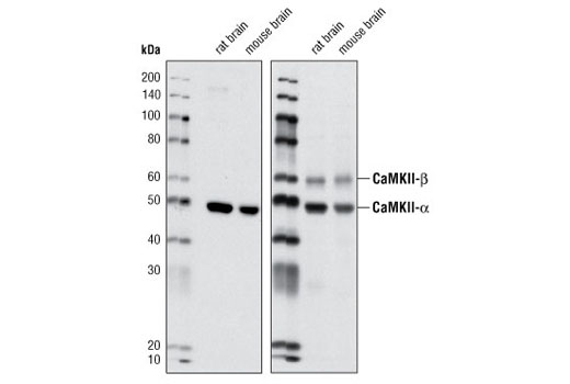 Western Blotting Image 2: CaMKII-α Antibody