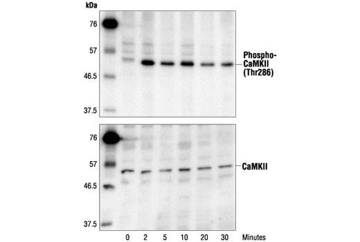 Western Blotting Image 1: Phospho-CaMKII (Thr286) Antibody