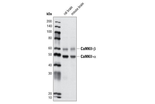 Western Blotting Image 1: CaMKII (pan) Antibody