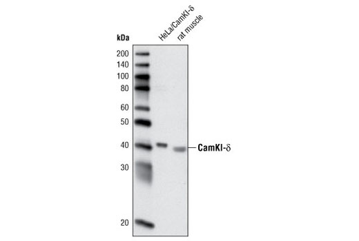 Western Blotting Image 1: CaMKI-δ Antibody
