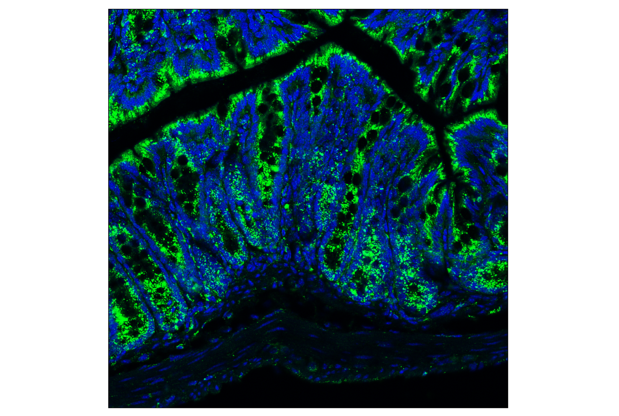 Immunofluorescence Image 1: HEXB (E9X5S) Rabbit mAb