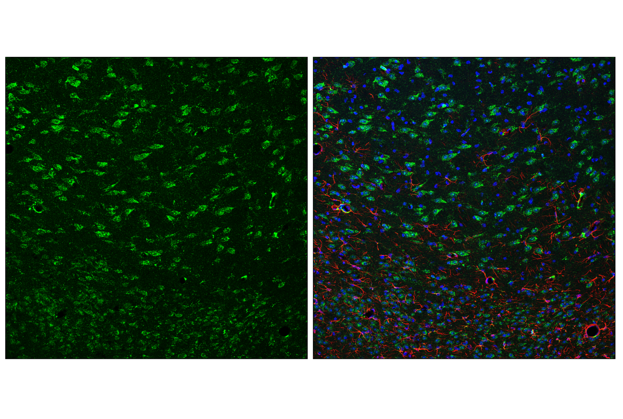 Immunofluorescence Image 3: HEXB (E9X5S) Rabbit mAb
