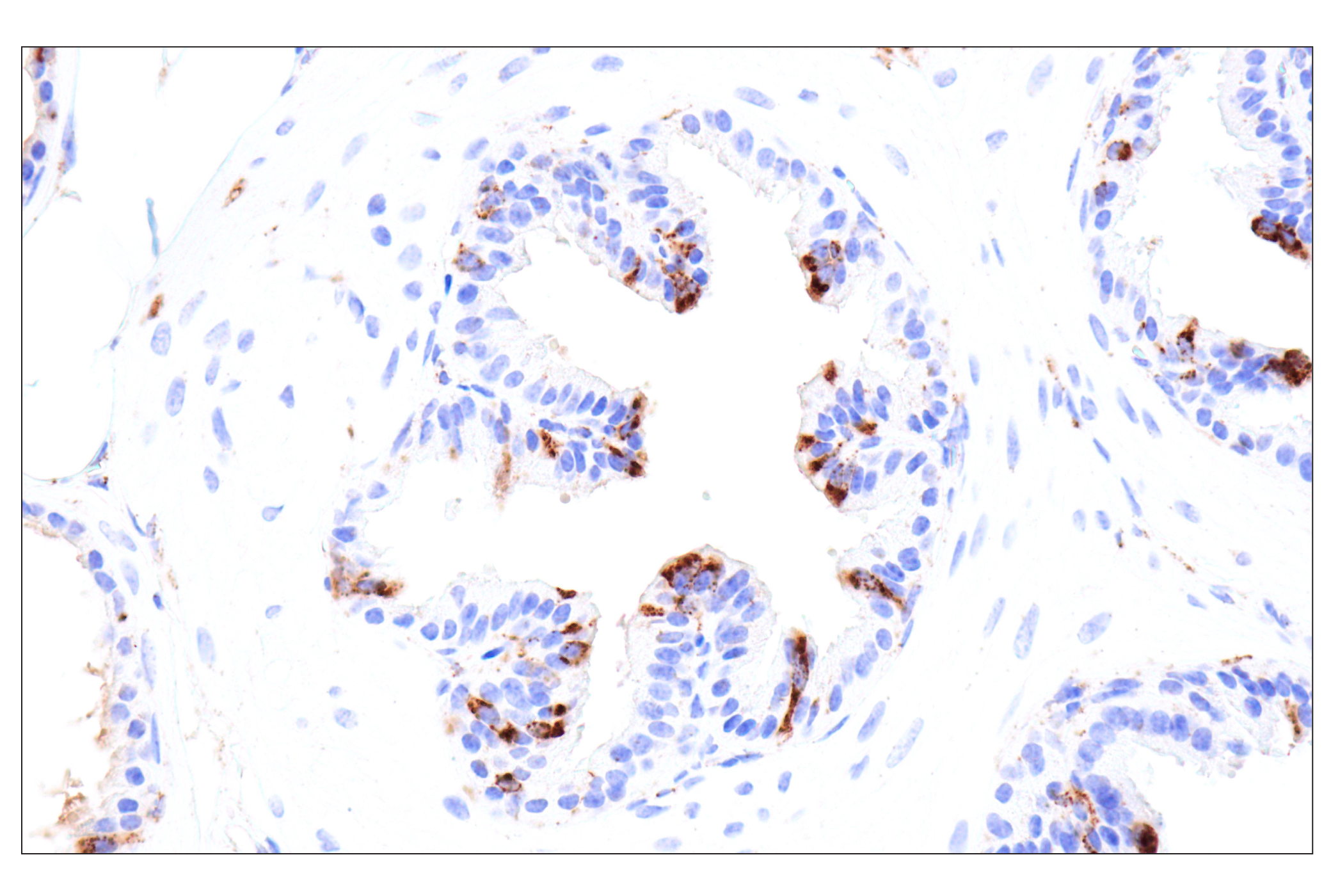 Immunohistochemistry Image 8: HEXB (E9X5S) Rabbit mAb