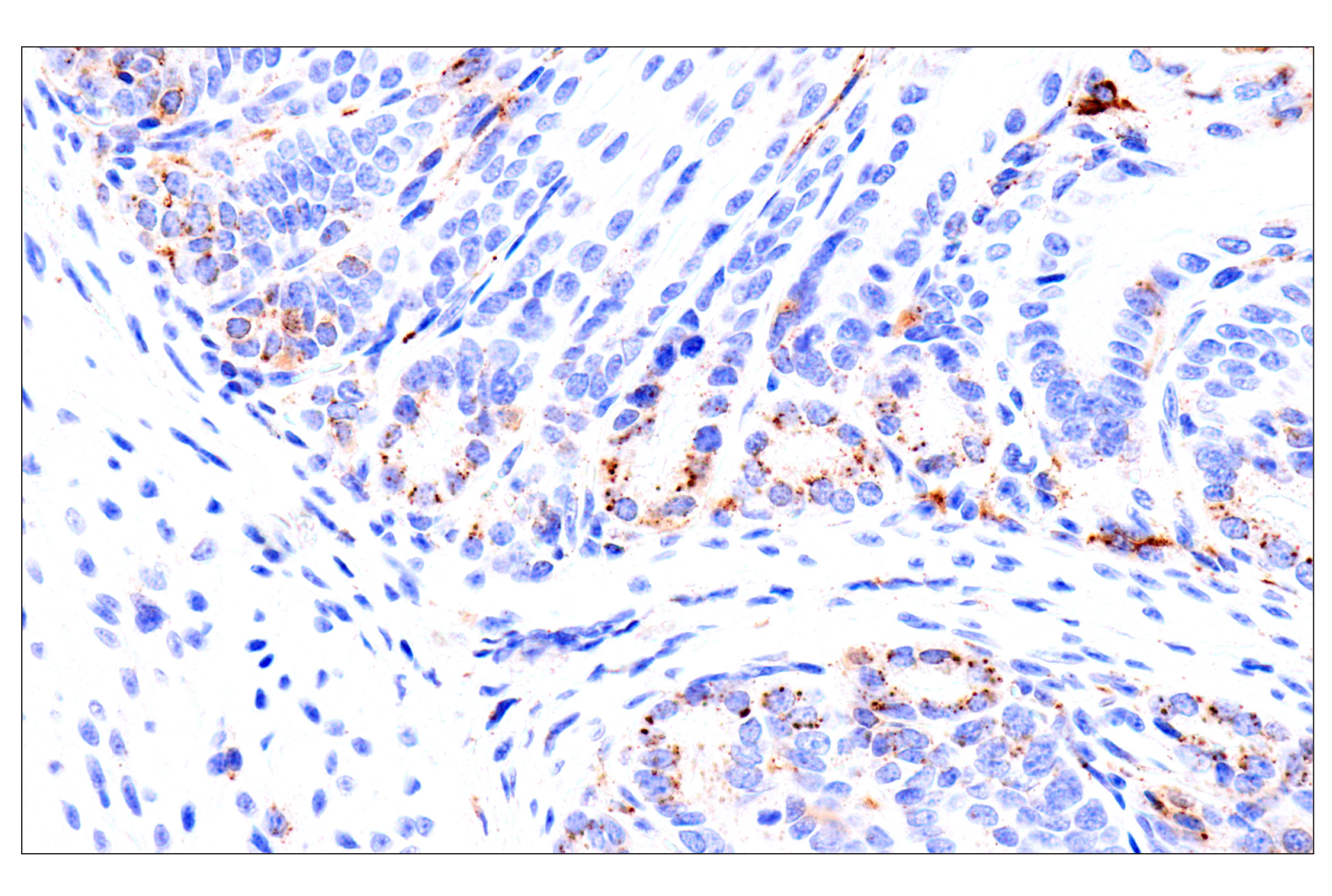 Immunohistochemistry Image 7: HEXB (E9X5S) Rabbit mAb