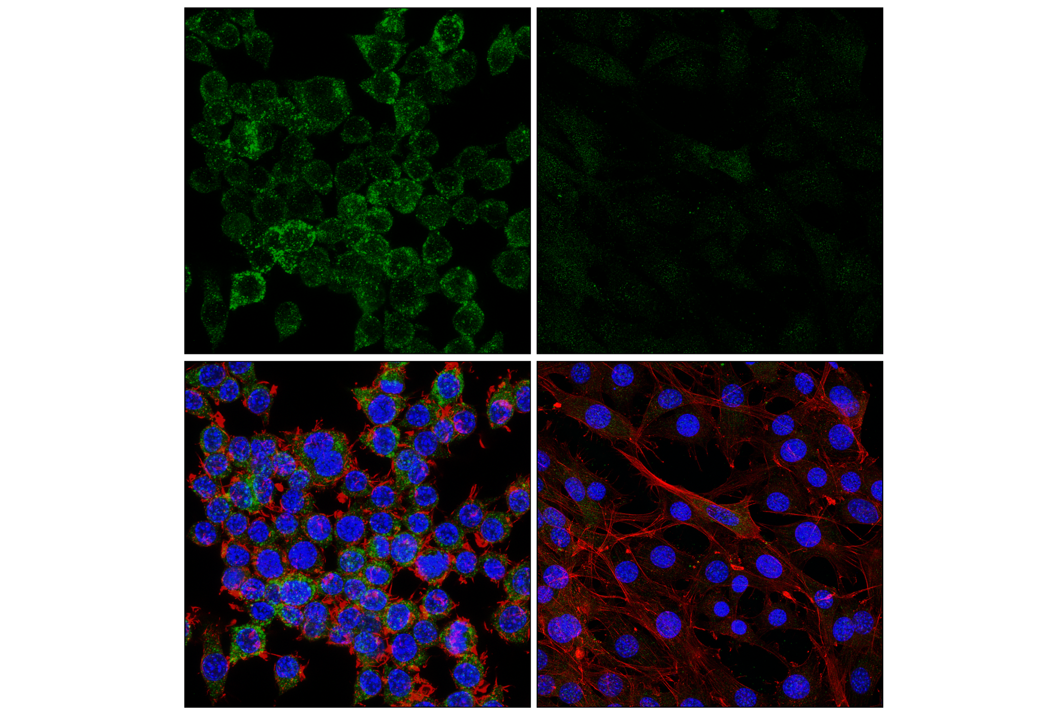 Immunofluorescence Image 4: HEXB (E9X5S) Rabbit mAb