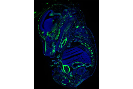 Immunofluorescence Image 1: Neuropilin-2 (D39A5) XP® Rabbit mAb
