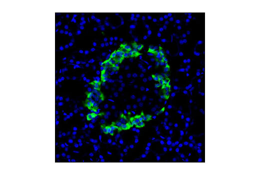 Immunofluorescence Image 2: Neuropilin-2 (D39A5) XP® Rabbit mAb