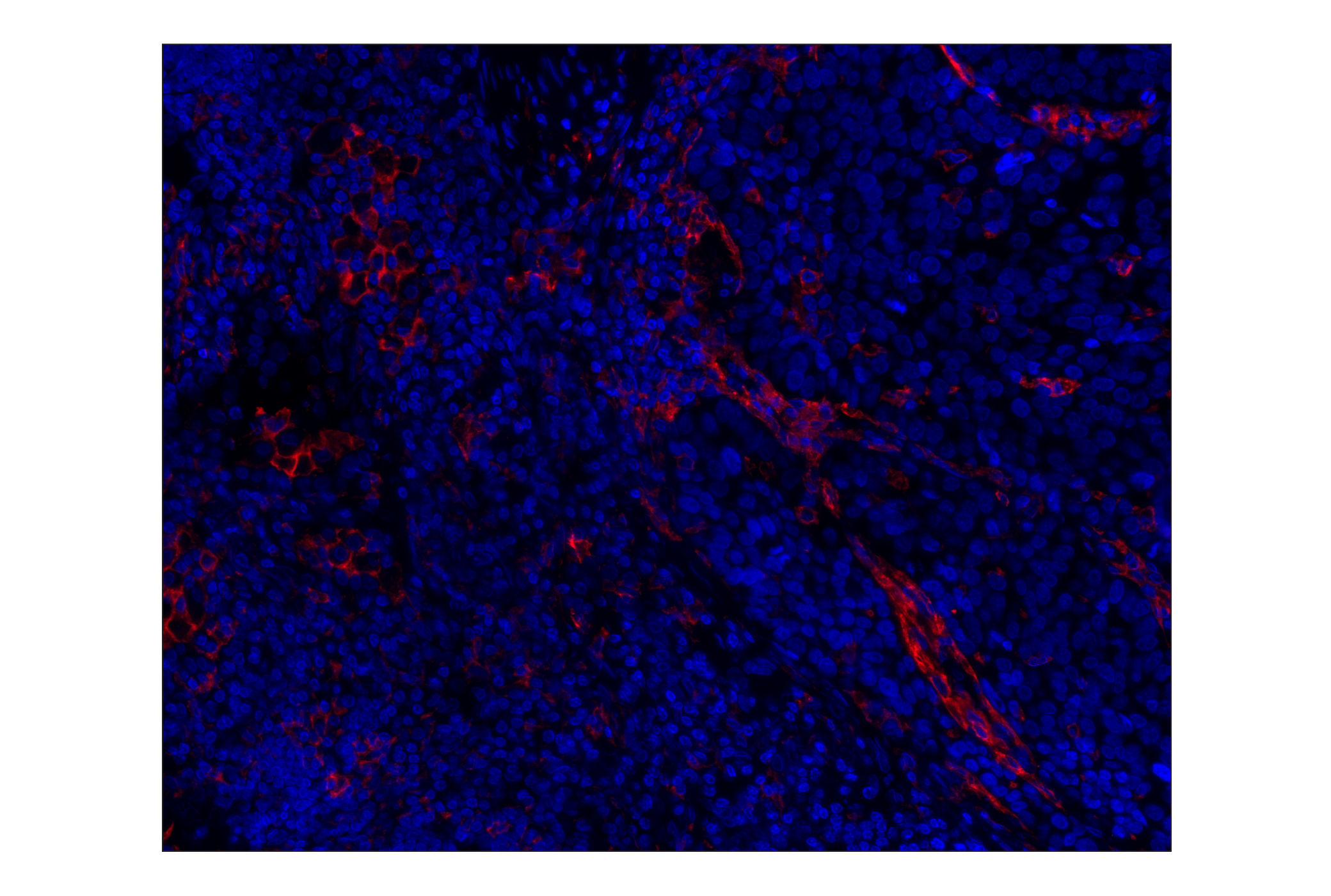 Immunohistochemistry Image 1: CD14 (D7A2T) Rabbit mAb (Alexa Fluor® 647 Conjugate)