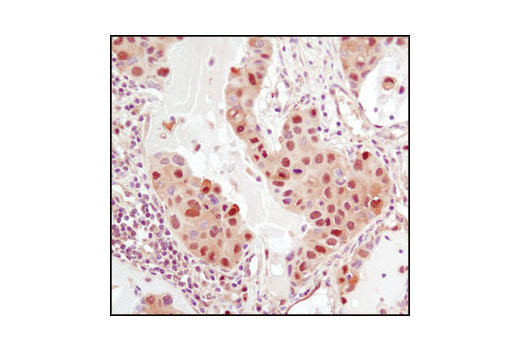 Immunohistochemistry Image 1: GSTP1 (3F2) Mouse mAb