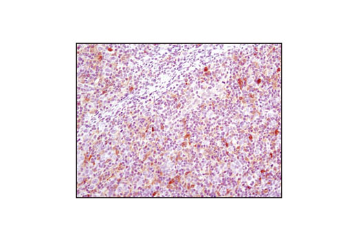 Immunohistochemistry Image 2: GSTP1 (3F2) Mouse mAb