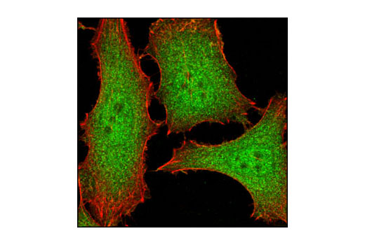 Immunofluorescence Image 1: GSTP1 (3F2) Mouse mAb