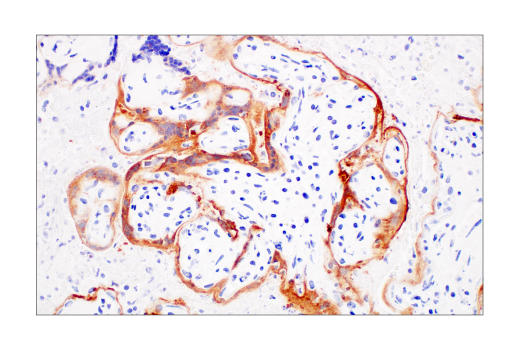 Immunohistochemistry Image 2: SARS-CoV-2 Nucleocapsid Protein (E8R1L) Mouse mAb