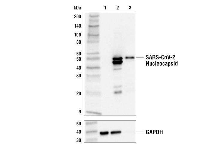 Western Blotting Image 1: SARS-CoV-2 Nucleocapsid Protein (E8R1L) Mouse mAb