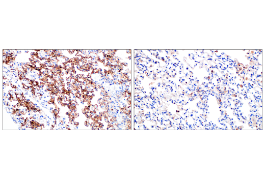 Immunohistochemistry Image 7: SARS-CoV-2 Nucleocapsid Protein (E8R1L) Mouse mAb