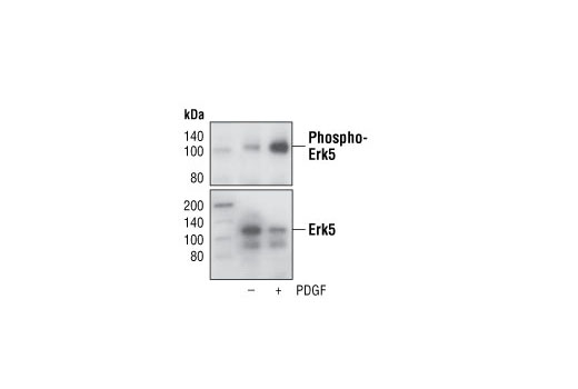Western Blotting Image 1: Phospho-Erk5 (Thr218/Tyr220) Antibody