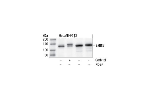 Western Blotting Image 1: Erk5 Antibody